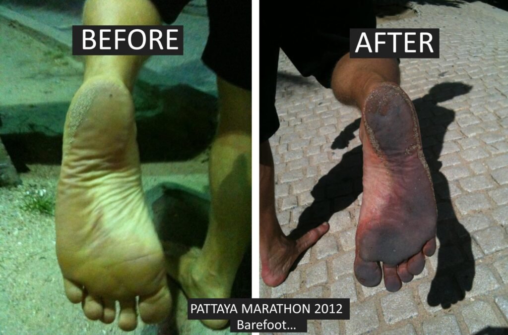 Pattaya Barefoot pic Marathon